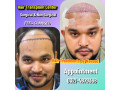 hair-wig-hair-patch-hair-extensions-small-1