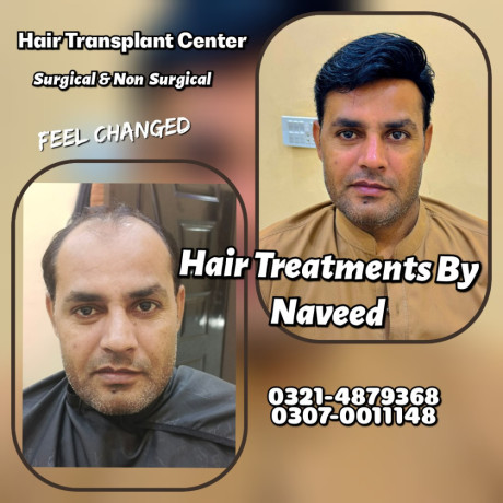 hair-wig-hair-patch-hair-extensions-big-4